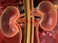 Viêm cầu thận - Tìm hiểu chi tiết về bệnh 