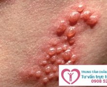 Ngứa rát âm đạo có nguy hiểm không?