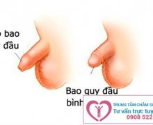 Dấu hiệu của tình trạng hẹp bao quy đầu