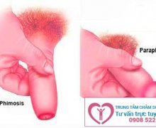 Đầu dương vật bị sưng đỏ và bọng nước là bệnh gì?