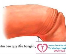 Đứt dây hãm bao quy đầu có nguy hiểm gì không?