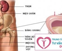 Biến chứng nguy hiểm của bệnh viêm bàng quang