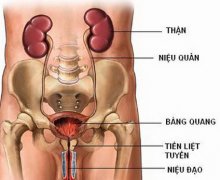 Cách chữa viêm đường tiết niệu hiệu quả