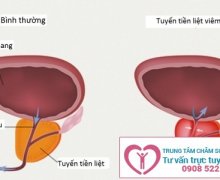 Bệnh viêm tinh hoàn và cách điều trị như thế nào?