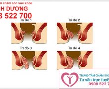 Dấu hiệu của các loại bệnh trĩ