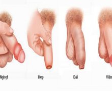 Viêm bao quy đầu có những dấu hiệu nhận biết gì?