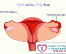 Đau lưng và tức bụng dưới là bệnh gì