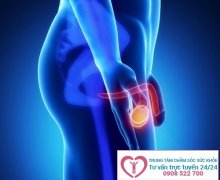 Trứng dái sưng đau bất thường là dấu hiệu của bệnh gì?