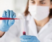 Tìm hiểu chi tiết chỉ số HgB là gì