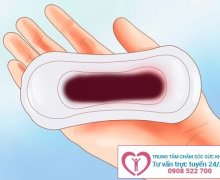 Hiện tượng rong kinh máu đen là bị bệnh gì?