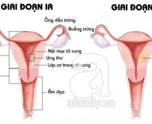 Liệu hình ảnh siêu âm lạc nội mạc tử cung có giúp chẩn đoán bệnh chính xác