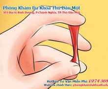 Huyết trắng có màu nâu đỏ và vón cục mắc bệnh gì