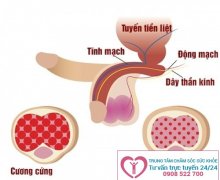 Dấu hiệu bệnh liệt dương ở nam giới