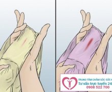 Ra máu báo thai có đau bụng không và cần chú ý điều gì?