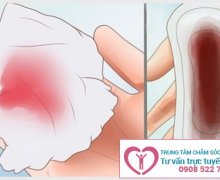 Máu báo có thai ra trong mấy ngày, ra máu báo bao lâu thì sinh?