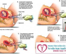 Thai 4 tháng tuổi có phá được không?