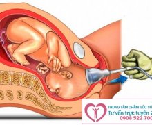 Nguyên nhân và dấu hiệu gây lở loét âm đạo