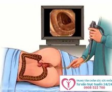Địa chỉ nội soi hậu môn uy tín tại Bình Dương