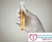 Nước tiểu đục có cặn là dấu hiệu của bệnh gì?