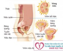 Nước tiểu đục là dấu hiệu của bệnh lý gì?
