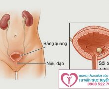 Phòng khám chữa viêm bàng quang hiệu quả tại Bình Dương