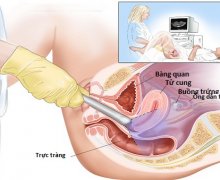 Kiểm tra tử cung vòi trứng nhiều lần có nguy hiểm không? 
