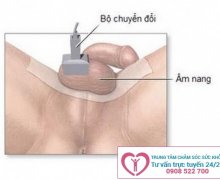 Chẩn đoán bệnh qua siêu âm tinh hoàn