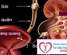 Khi mắc bệnh viêm bàng quang có quan hệ được không?
