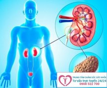 Nguyên nhân và những ảnh hưởng của viêm bàng quang