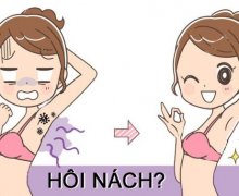 Những thủ phạm gây ra chứng hôi nách