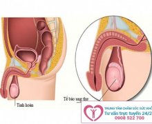 Lý giải hiện tượng tinh hoàn đau tức
