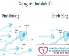 Vì sao nam giới lại bị hiếm muộn?