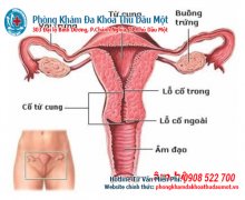  Viêm âm đạo - viêm niệu đạo căn bệnh phụ khoa thường gặp nhất