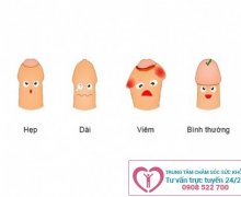 Viêm bao quy đầu điều trị như thế nào cho hiệu quả?