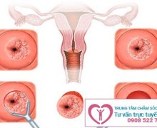 Giải quyết nỗi lo vùng kín có mùi hôi