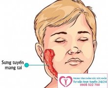 Chi phí chữa bệnh viêm tinh hoàn là bao nhiêu?
