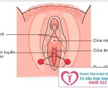 Viêm tuyến Bartholin và nguyên nhân gây bệnh