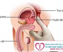 Vôi Hóa Tuyến Tiền Liệt Nguy Hiểm Như Thế Nào?