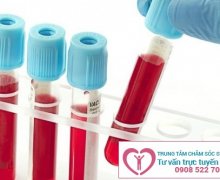Xét nghiệm HPV ở đâu tốt tại Bình Dương