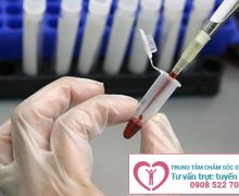 Xét nghiệm sùi mào gà nhanh chóng, chính xác