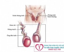 Đau tinh hoàn và những điều cần biết