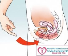 Hiện tượng tinh binh đi ngược ngay phút thăng hoa