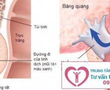 Quan hệ lâu xuất tinh có sao không?