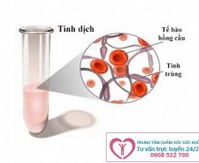Điều trị xuất tinh ra máu như thế nào ?